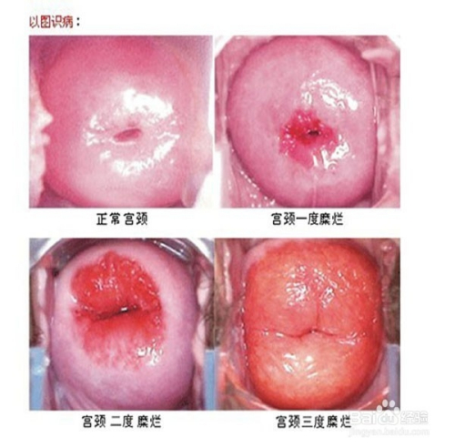 治療方法探討