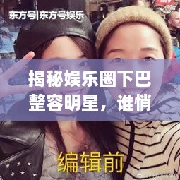 揭秘娛樂圈下巴整容明星，誰悄悄整過下巴？