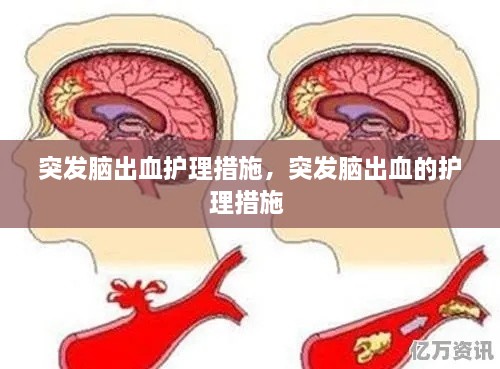 突發(fā)腦出血護(hù)理措施，突發(fā)腦出血的護(hù)理措施 