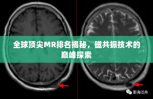 全球頂尖MR排名揭秘，磁共振技術(shù)的巔峰探索