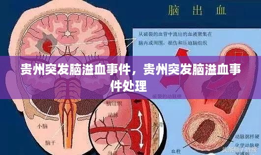 貴州突發(fā)腦溢血事件，貴州突發(fā)腦溢血事件處理 